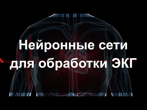 Видео: Обзор методов обработки ЭКГ
