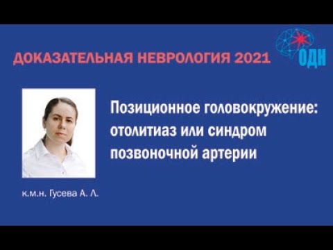 Видео: Позиционное головокружение: отолитиаз или синдром позвоночной артерии