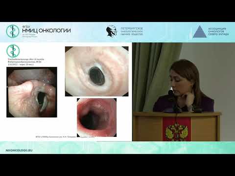 Видео: Опухоли шейного отдела пищевода, гортаноглотки, методы пластики, голосовое протезирование