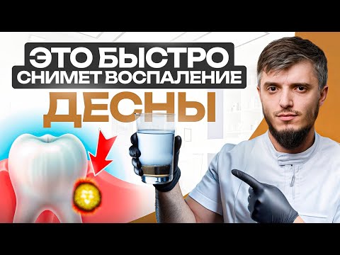 Видео: НЕ делайте так при воспалении десен! Как быстро снять воспаление десен в домашних условиях