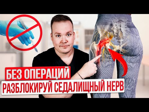 Видео: Защемило СЕДАЛИЩНЫЙ нерв. Делай СРОЧНО эти упражнения ДОМА. Боль уйдет за 5 минут