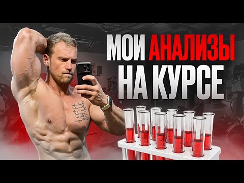 Видео: Анализы на курсе. Что нужно смотреть? Густота, липидный профиль и т.д.