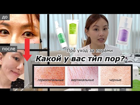 Видео: ПОСМОТРИТЕ ЗЕРКАЛО. ЕСЛИ ВЕРТИКАЛЬНЫЕ ПОРЫ ТО УЖЕ КОЖА НАЧАЛА СТАРЕТЬ (уход за вертикальными порами)