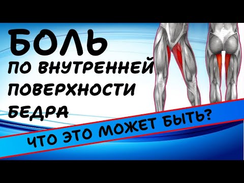 Видео: БОЛЬ ПО ВНУТРЕННЕЙ ПОВЕРХНОСТИ БЕДРА | ЧТО ЭТО МОЖЕТ БЫТЬ?