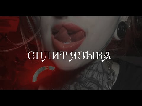 Видео: сплит языка | о заживлении | боли | как проходила процедура