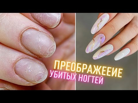 Видео: БЕДНЕНЬКИЕ НОГОТКИ! Маникюр самой себе. Наращивание на верхние формы. Преображение ногтей