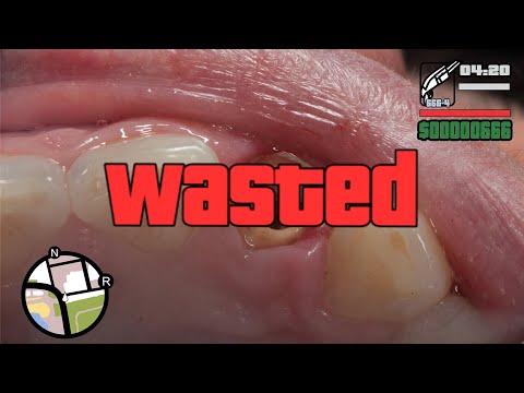 Видео: Стомбудни #6.  НИКОГДА ТАК НЕ ПРОТЕЗИРУЙ