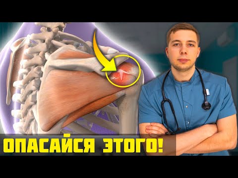 Видео: Боль В Плече - Импиджмент-синдром! Это ОПАСНЕЕ, чем ты думаешь...