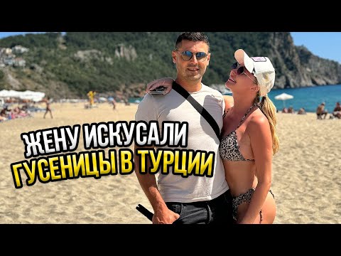 Видео: VLOG// Резкая АЛЛЕРГИЯ у Дарьи Пынзарь, не знаем чем лечить.