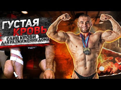 Видео: Густая кровь. Разжижение крови самым эффективным методом! Капельница в домашних условиях. Слив крови