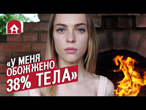 Видео: Девушка с ожогами: Даша | Быть молодым