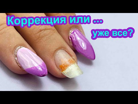 Видео: Когда Коррекцию Ногтей Делать уже ПОЗДНО? Замурованные Отслойки