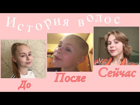 Видео: ПОБРИЛАСЬ НАЛЫСО/ЧТО ПРОИЗОШЛО ЗА ГОД