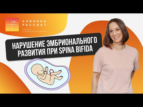 Видео: Нарушение эмбрионального развития при spina bifida