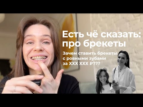 Видео: УЛЫБКА НА МИЛЛИОН | Брекеты: сколько стоят брекеты, как устанавливают и почему не элайнеры?