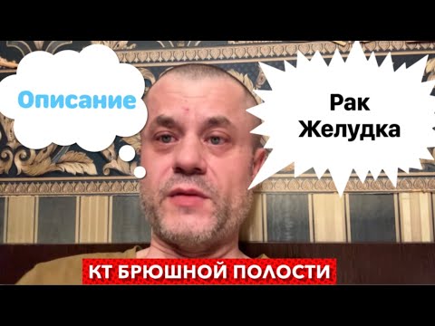 Видео: Рак Желудка - Готово описание КТ брюшной полости с контрастом. Лечение рака по ОМС в частной клинике