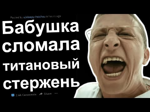Видео: ВРАЧИ РЕДДИТ, КОГДА ВЫ ЗРЯ НЕ ПОВЕРИЛИ ПАЦИЕНТУ