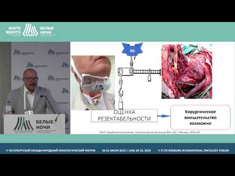 Видео: Мультидисциплинарный подход в лечении рецидива плоскоклеточного рака головы и шеи (Кравцов С.А.)