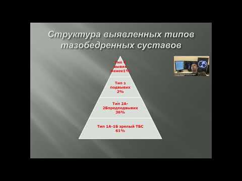 Видео: Ультразвуковая диагностика дисплазии тазобедренных суставов у детей 1 года жизни.