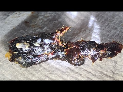 Видео: 861 - Экстремальное удаление ушной серы