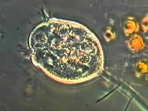 Видео: Трубач, стилонихия, сувойки, сосущие инфузории