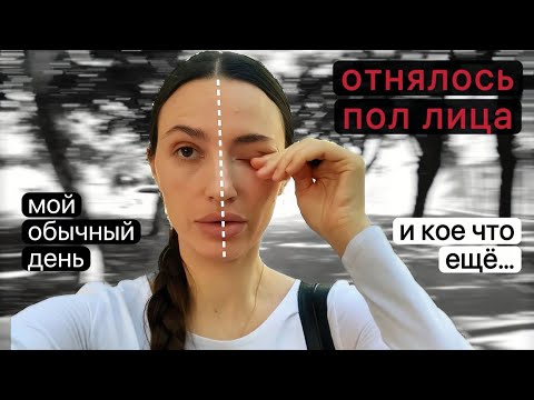 Видео: ЧТО СЛУЧИЛОСЬ с лицом? Кем работаю? Кто и что меня БЕСИТ? Что теперь ем? Мой влог vlog