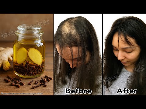 Видео: 😱Я в шоке, волосы на моей лысой голове растут как сумасшедшие и не выпадают 🔥💯