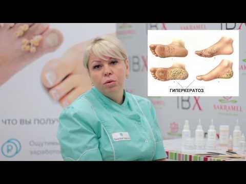 Видео: Мастер-класс DoctorDerm: аппаратная обработка глубоких трещин на пятках