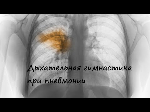 Видео: Дыхательная гимнастика при пневмонии (воспалении легких)