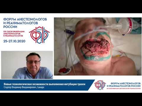Видео: Новые технологии интубации трахеии Стадлер В.В.
