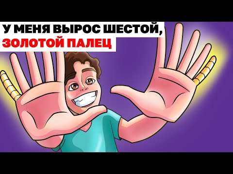 Видео: У Меня Вырос Шестой, Золотой Палец | Анимированная История про тело