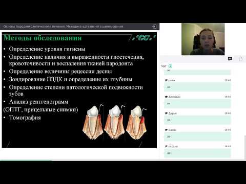 Видео: Адгезивное шинирование.  Основы пародонтологического лечения (Вебинар от 17.11.17)