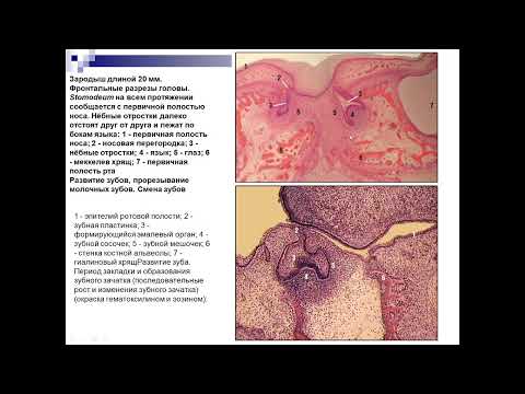 Видео: 24. Гистологическое строение зуба