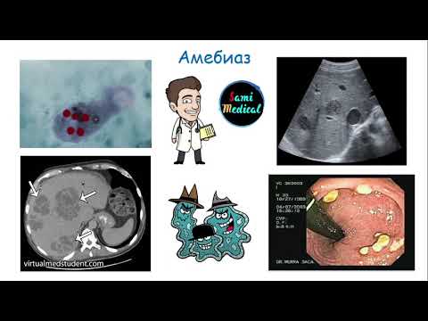 Видео: Амебиаз | Патогенез | Клиника | Диагностика | Лечение | Профилактика (Легко, Понятно, Интересно)