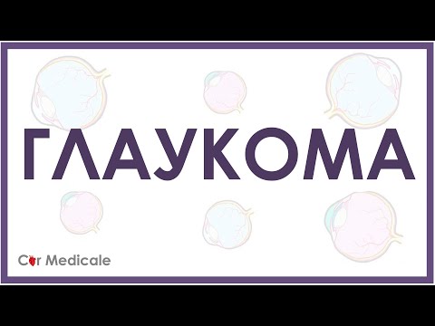 Видео: Глаукома - что такое, причины и симптомы