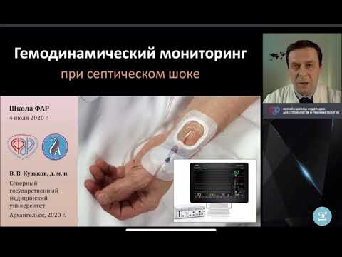 Видео: Гемодинамический мониторинг при септическом шоке Кузьков В В