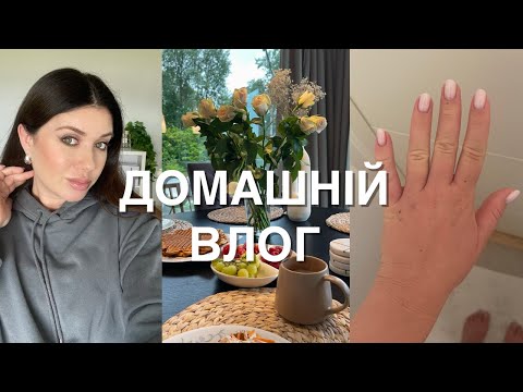Видео: ВЛОГ : ОСТАННІ МІСЯЦІ ВАГІТНОСТІ, ПОБУТ, ЛІКАРНЯ І БАГАТО ЧОГО ІНШОГО