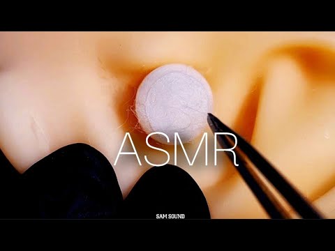 Видео: ASMR Уши забиты ватной серой! Чистка ушей с гарантированным покалыванием