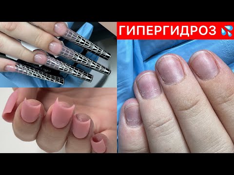 Видео: АРОЧНОЕ НАРАЩИВАНИЕ ИЛИ САЛОННОЕ МОДЕЛИРОВАНИЕ🤔ПРЕОБРАЖЕНИЕ НОГТЕЙ С ГИПЕРГИДРОЗОМ 💦