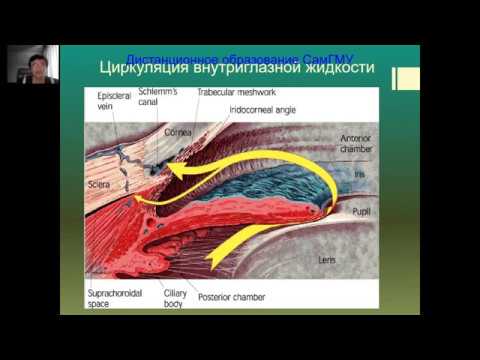 Видео: Глаукома Часть 1