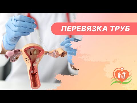 Видео: 🔴 Перевязка труб