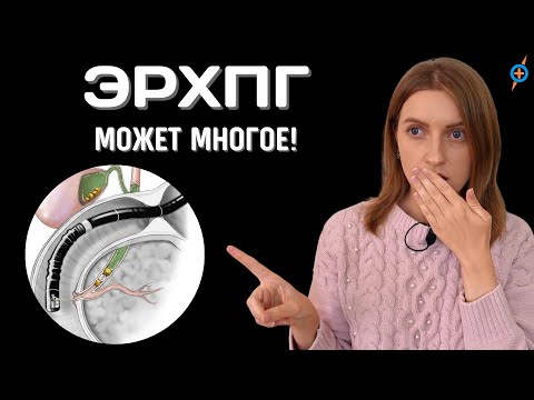 Видео: Что такое ЭРХПГ? Диагностика и лечение протоков печени и поджелудочной железы | Mednavigator.ru