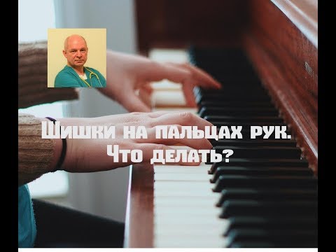 Видео: Шишки на пальцах рук.  Что делать?#шишкинапальцах