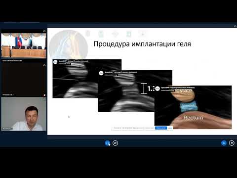 Видео: Осложнения лучевой терапии рака  простаты