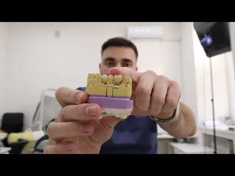 Видео: ЗУБ ИЛИ ИМПЛАНТ?