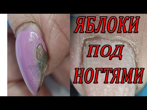 Видео: ВОЗРАСТНОЙ МАНИКЮР //  МАНИКЮР В МАКРО // ОГОРОД И ЯБЛОКИ ПОД НОГТЯМИ