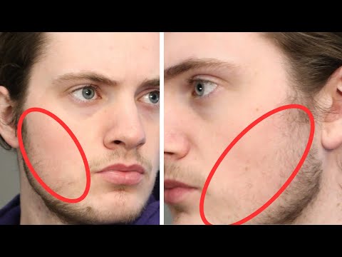 Видео: 6 признаков того, что у вас никогда не отрастет борода (согласно науке)