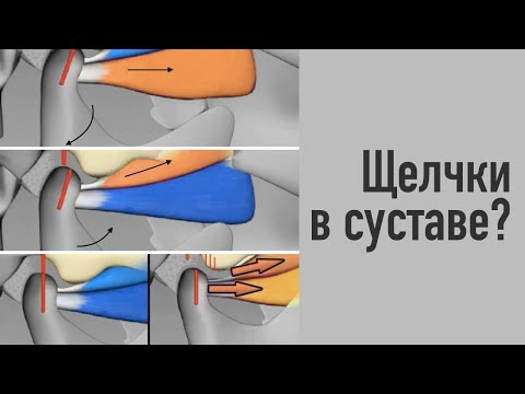 Видео: Щелчки в ВНЧС. Как они появляются и почему это не норма.