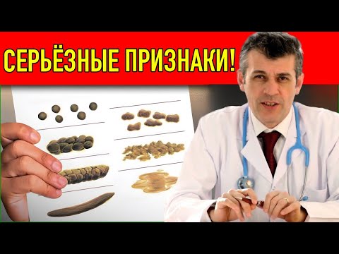 Видео: Врач Предупреждает Это Худший Тип Стула! Никогда Не Игнорируйте!
