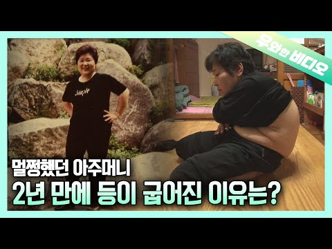 Видео: Женщина, чья спина затвердела под прямым углом